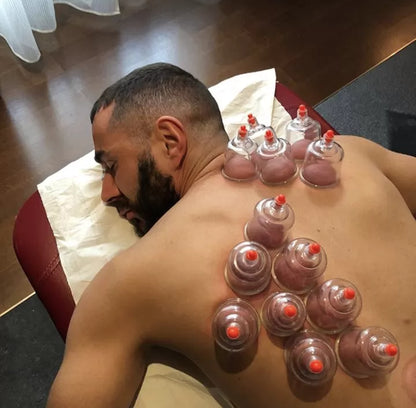 Hijama Nass und Trockenschröpfen